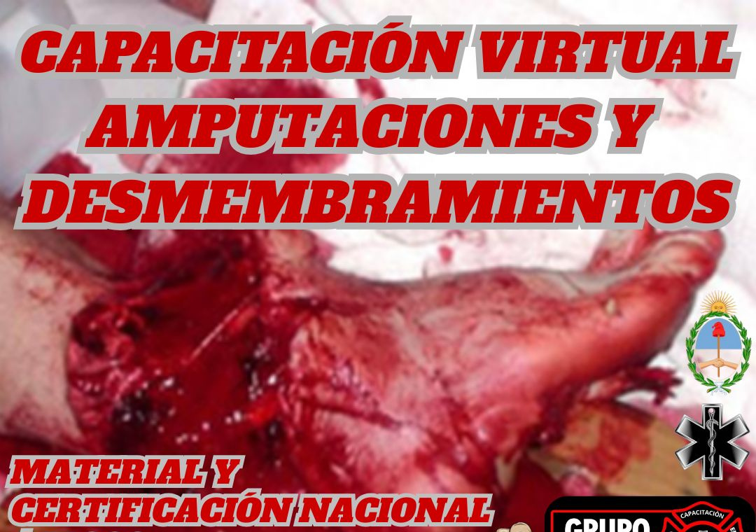 Amputaciones y Desmembramientos: El Protocolo de Emergencia que Muy Pocos Conocen y Todos Deberían Tener